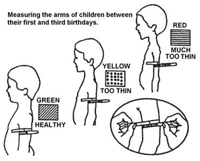 Illustration of how to measure a child's arm to ensure they're at a healthy weight.